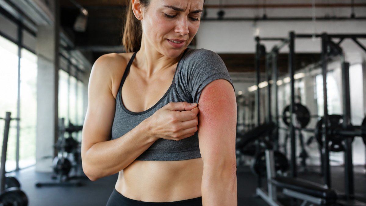 Why Synthetic Workout Clothes Cause Irritation
