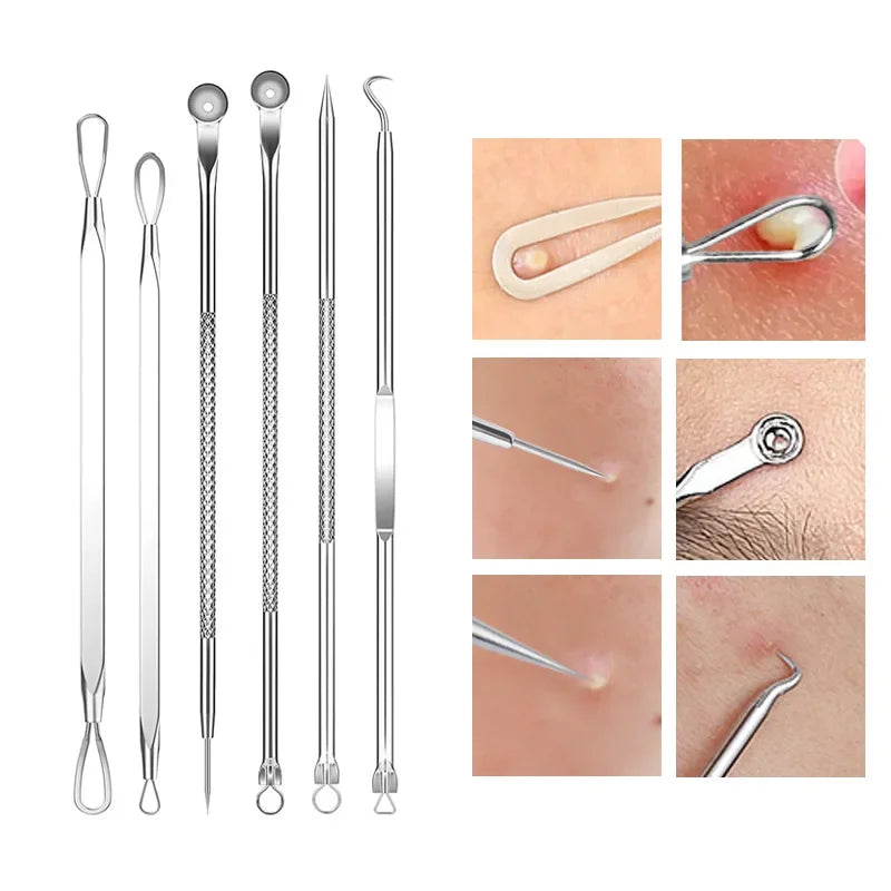 4-11 pcs Ingrown Hair Tweezers Acne Blackhead Removal Needles Black Dots Cleaner Deep Cleansing Pore Cleaner Face Skin Care Tools