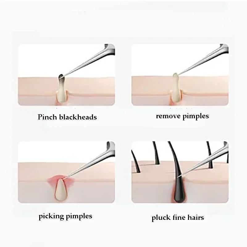 4-11 pcs Ingrown Hair Tweezers Acne Blackhead Removal Needles Black Dots Cleaner Deep Cleansing Pore Cleaner Face Skin Care Tools